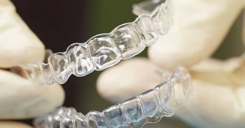 Who Can Benefit from an Occlusal Splint?